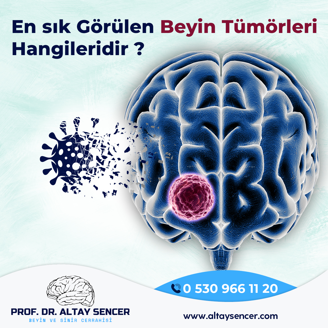 En sık görülen beyin tümörleri hangileridir?